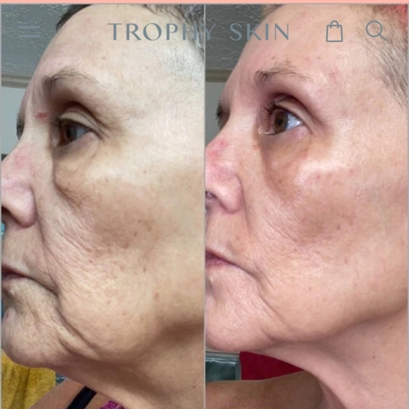 TROPHY SKIN BRIGHTEN MD - Picture 6 of 11